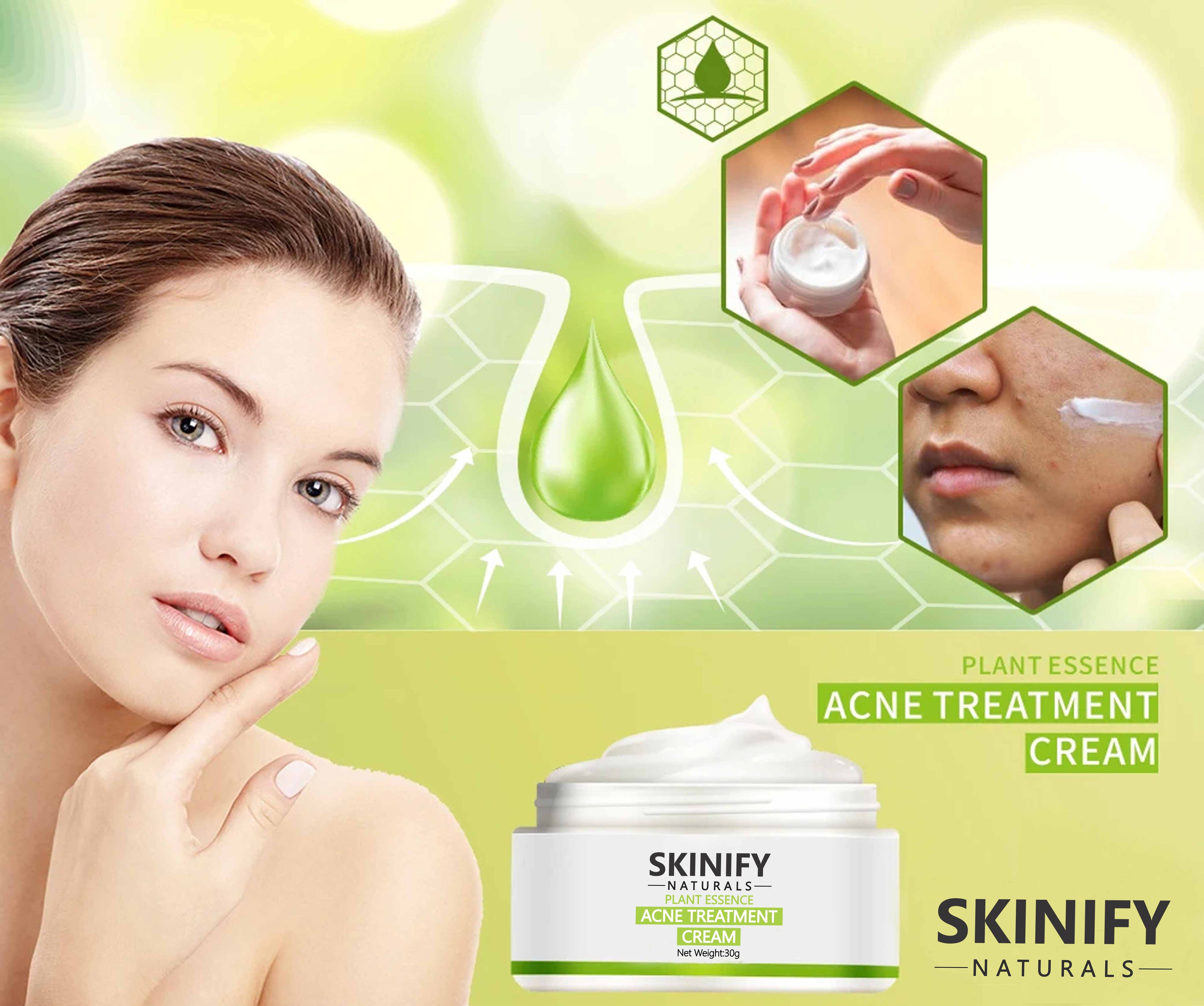 SKINIFY ACNE TREATMENT CREAM