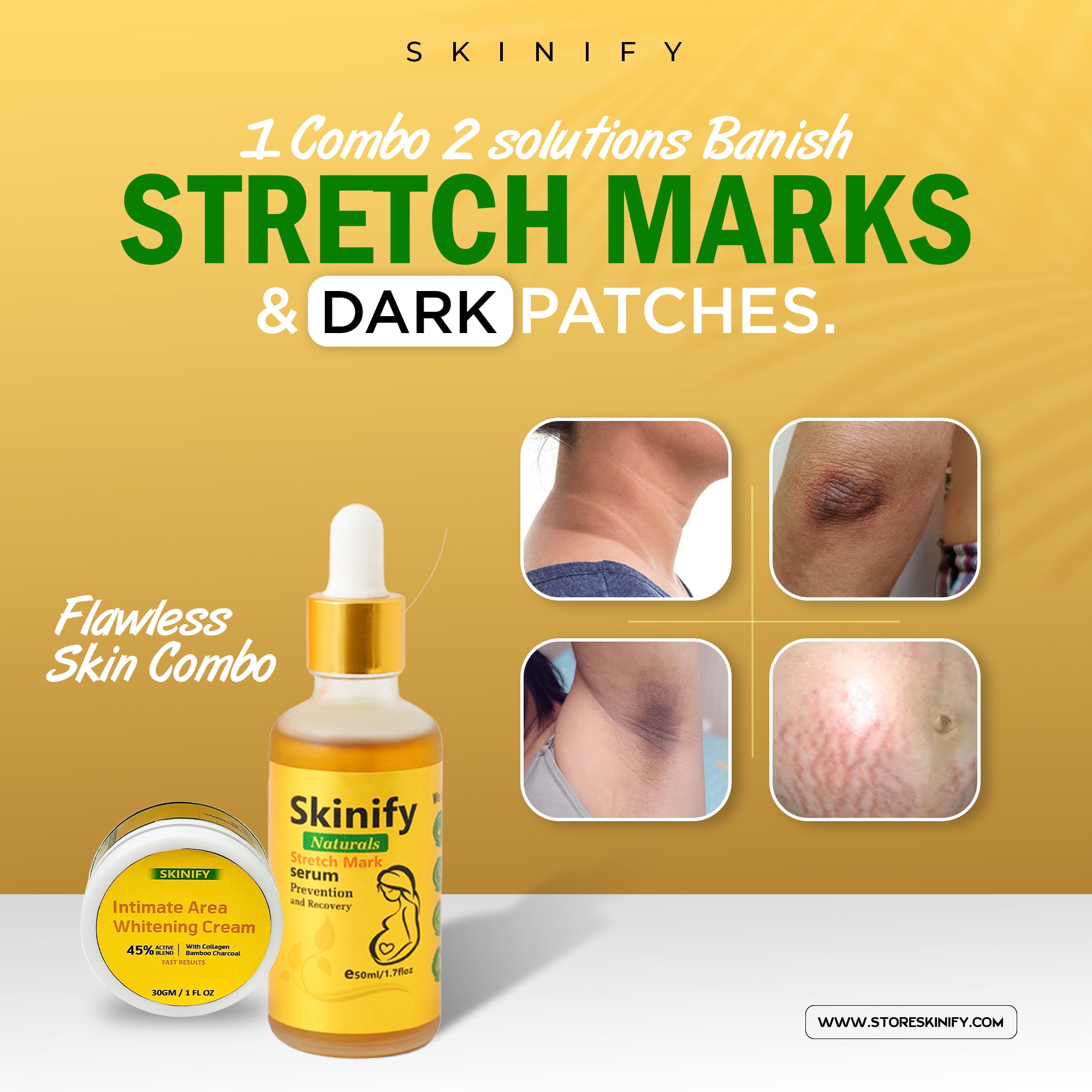 SKINIFY SPECIAL FLAWLESS COMBO