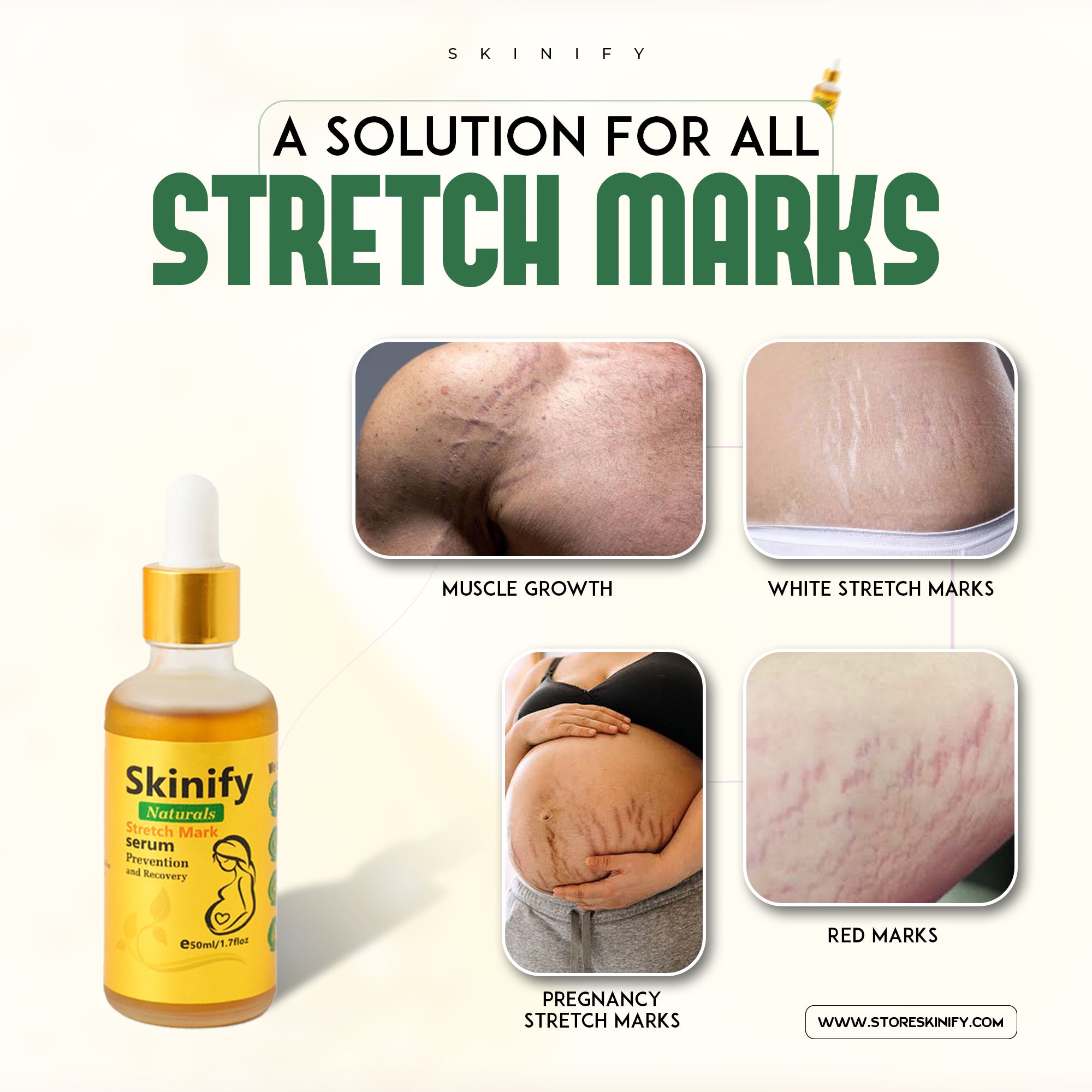SKINIFY Stretch Marks Removal Maternity Skin Body Repair Serum